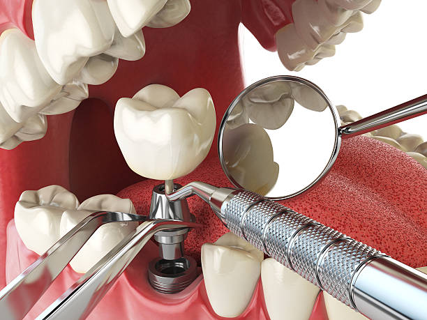 Best Urgent Tooth Repair  in Hawi, HI